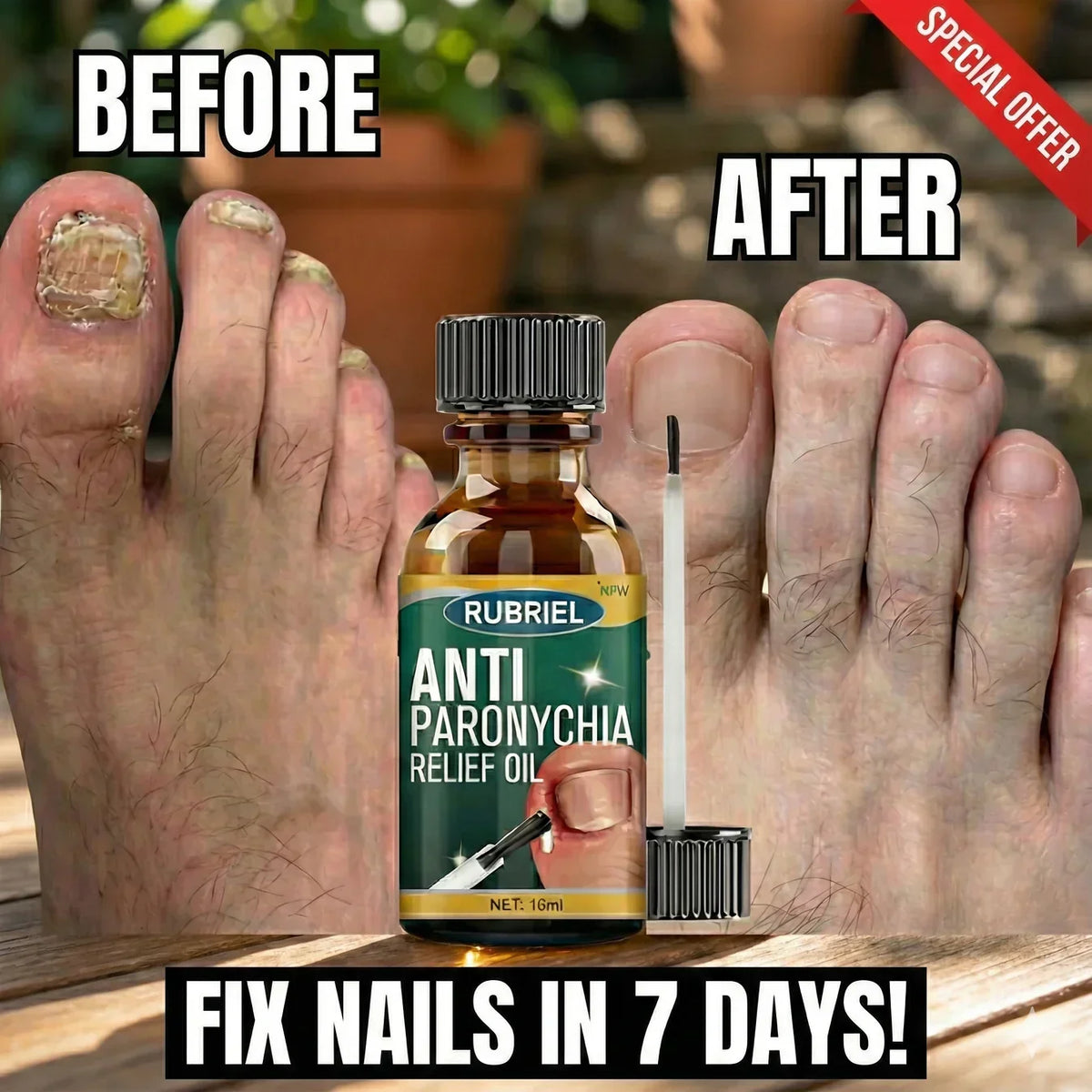 Anti Paronychia Relief Oil - (Buy 1 Get 1  FREE)