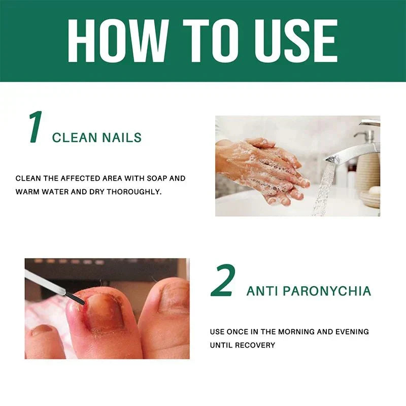 Anti Paronychia Relief Oil - (Buy 1 Get 1  FREE)